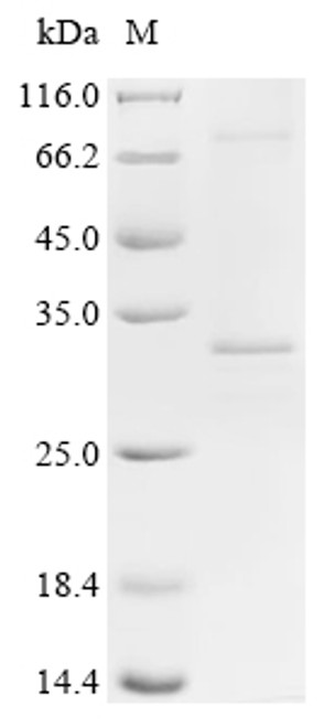 Recombinant Human ATP synthase subunit C lysine N-methyltransferase (ATPSCKMT) (CSB-CF761288HU) Recombinant Human ATP synthase subunit C lysine N-methyltransferase (ATPSCKMT) (CSB-CF761288HU)