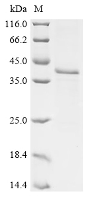 Recombinant Hepatitis B virus genotype D subtype ayw Large envelope protein (S) (CSB-CF724165HEN) Recombinant Hepatitis B virus genotype D subtype ayw Large envelope protein (S) (CSB-CF724165HEN)