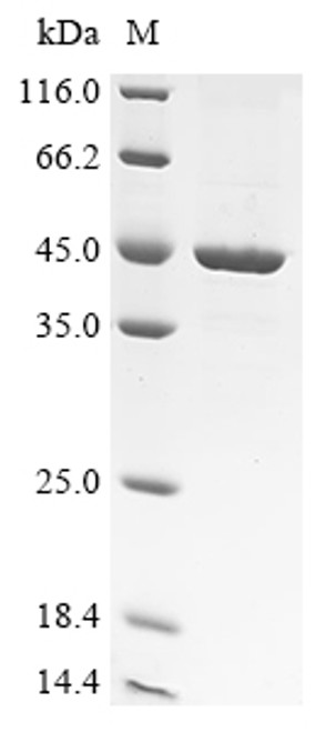 Recombinant Human Arylacetamide deacetylase (AADAC) (CSB-CF001014HU(A4))