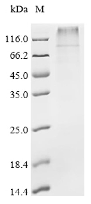 Recombinant Pig Potassium voltage-gated channel subfamily KQT member 1 (KCNQ1) (CSB-CF871323PI) Recombinant Pig Potassium voltage-gated channel subfamily KQT member 1 (KCNQ1) (CSB-CF871323PI)