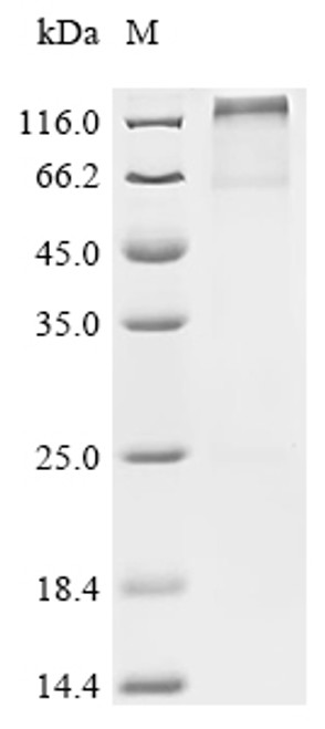 Recombinant Cynomolgus monkey Potassium voltage-gated channel subfamily KQT member 1 (KCNQ1) (CSB-CF5299MOV) Recombinant Cynomolgus monkey Potassium voltage-gated channel subfamily KQT member 1 (KCNQ1) (CSB-CF5299MOV)