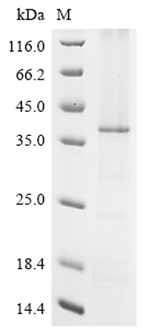 Recombinant Macaca fascicularis Zinc transporter ZIP6 isoform X1 (SLC39A6), partial (CSB-CF5043MOV) Recombinant Macaca fascicularis Zinc transporter ZIP6 isoform X1 (SLC39A6), partial (CSB-CF5043MOV)