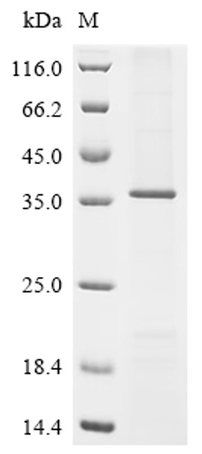 Recombinant Rat Zinc transporter ZIP6 (Slc39a6), partial (CSB-CF687169RA1)