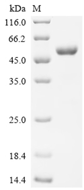 Recombinant Human Cytotoxic T-lymphocyte protein 4 (CTLA4), partial, Biotinylated (CSB-MP006163HU1j1-B) Recombinant Human Cytotoxic T-lymphocyte protein 4 (CTLA4), partial, Biotinylated (CSB-MP006163HU1j1-B)