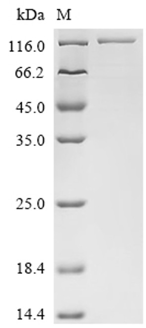 Recombinant Mouse Carcinoembryonic antigen-related cell adhesion molecule 5 (Ceacam5) (CSB-MP005165MO(A4)) Recombinant Mouse Carcinoembryonic antigen-related cell adhesion molecule 5 (Ceacam5) (CSB-MP005165MO(A4))