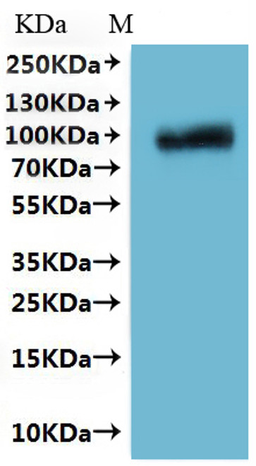 Recombinant Crimean-Congo hemorrhagic fever virus Envelopment polyprotein (GP), partial-VLPs (CSB-MP810349CSC) Recombinant Crimean-Congo hemorrhagic fever virus Envelopment polyprotein (GP), partial-VLPs (CSB-MP810349CSC)
