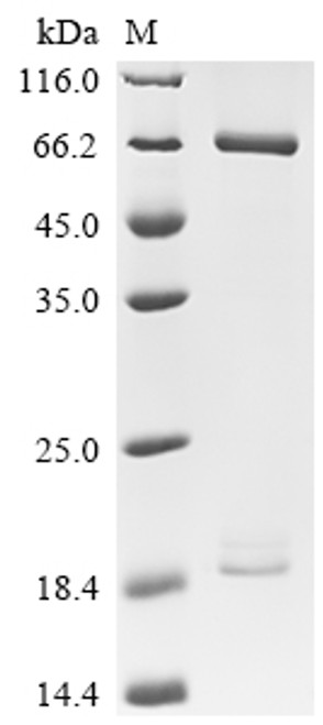 Recombinant Human Proprotein convertase subtilisin/kexin type 9 (PCSK9) (D374Y), Biotinylated (Active) (CSB-MP017647HU(M)-B) Recombinant Human Proprotein convertase subtilisin/kexin type 9 (PCSK9) (D374Y), Biotinylated (Active) (CSB-MP017647HU(M)-B)