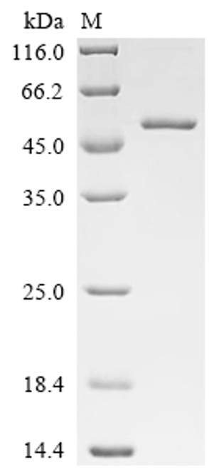 Recombinant Human Glutathione peroxidase 3 (GPX3) (U73C) (CSB-MP009868HU(M)) Recombinant Human Glutathione peroxidase 3 (GPX3) (U73C) (CSB-MP009868HU(M))