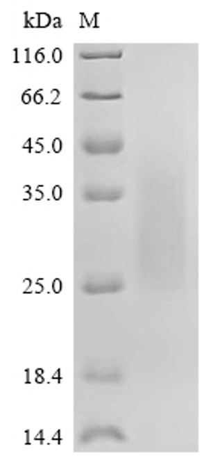 Recombinant Macaca fascicularis NKG2A protein (nkg2A), partial (CSB-MP5045MOV)