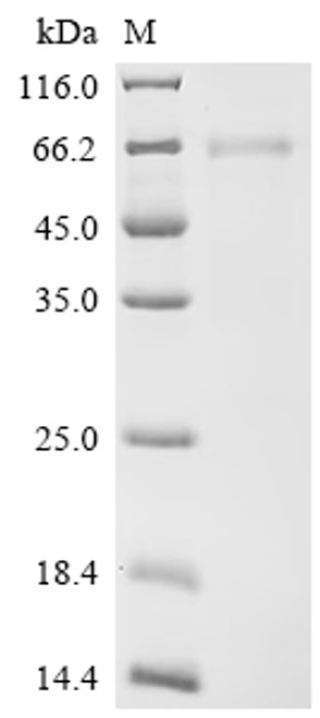 Recombinant Human Tumor necrosis factor receptor superfamily member 6B (TNFRSF6B) (CSB-MP023982HU)