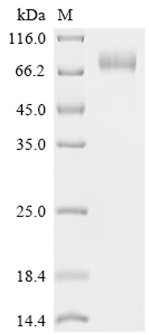 Recombinant Human B-lymphocyte antigen CD19 (CD19), partial, Biotinylated (CSB-MP004888HU-B)