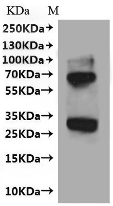 Recombinant Human Very-long-chain enoyl-CoA reductase (TECR) (CSB-CF865186HU)