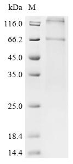 Recombinant Bovine Parathyroid hormone/parathyroid hormone-related peptide receptor (PTH1R) (CSB-CF630854BO)