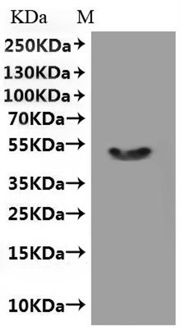 Recombinant Human Transient receptor potential cation channel subfamily M member 8 (TRPM8), partial-VLPs (CSB-MP768757HU1)