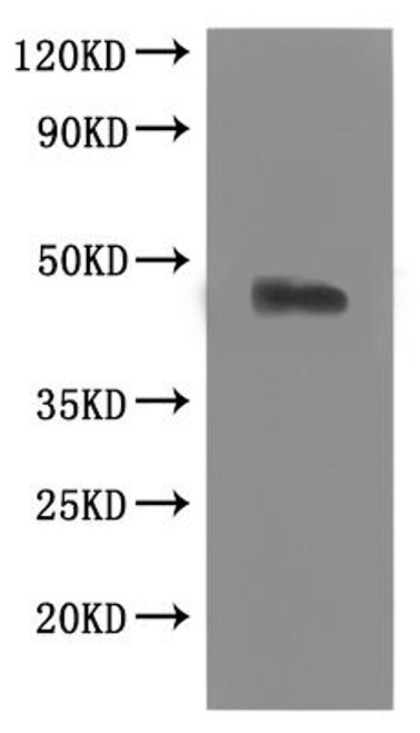 Recombinant Macaca mulatta C-C chemokine receptor type 8 (CCR8)-VLPs (CSB-MP004847MOW)