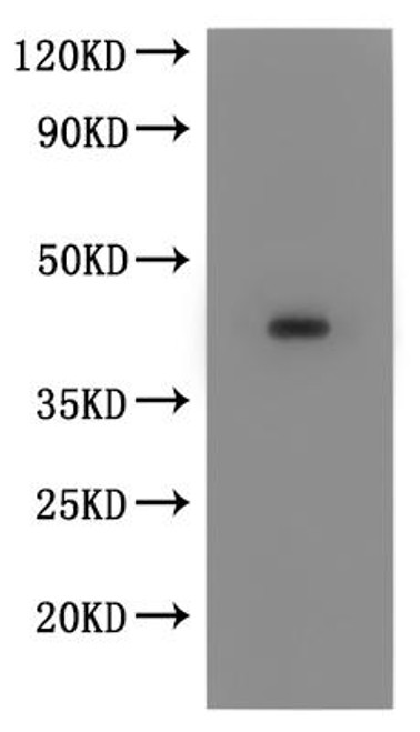 Recombinant Macaca fascicularis Chemokine receptor 8 (CCR8)-VLPs (CSB-MP2709MOV)