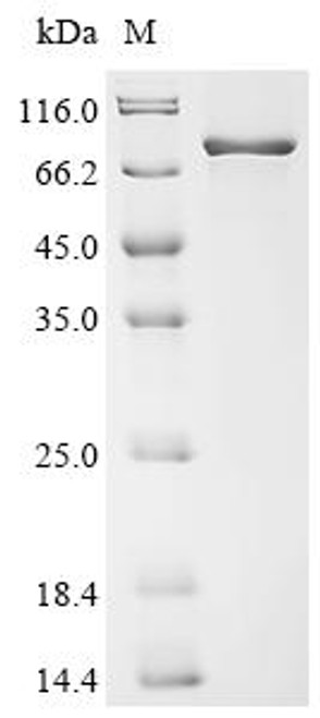 Recombinant Mouse Protein-arginine deiminase type-2 (Padi2) (CSB-MP3642MO)