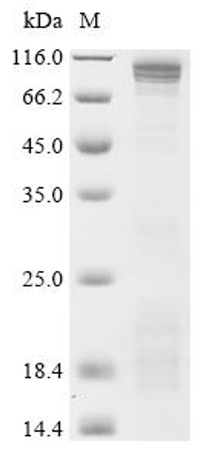 Recombinant Human cGMP-specific 3',5'-cyclic phosphodiesterase (PDE5A) , partial (CSB-YP524921HU)