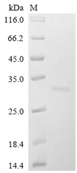 Recombinant Human Bcl-2-like protein 11 (BCL2L11) (CSB-YP002615HUm3)