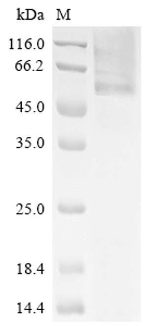 Recombinant Human Glucosylceramidase (GBA) (CSB-YP009289HU)