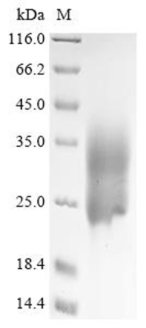 Recombinant Human metapneumovirus Fusion glycoprotein F0 (F), partial (CSB-YP751041HDAM1)