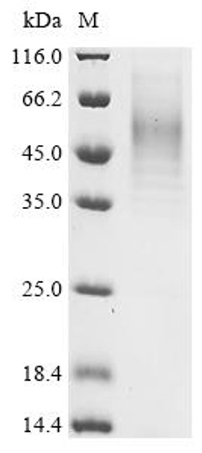 Recombinant Staphylococcus aureus Alpha-hemolysin (hly) (CSB-YP357716FKZ)