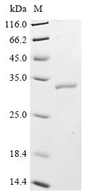 Recombinant Human CCR4-NOT transcription complex subunit 7 (CNOT7) (CSB-YP883446HU)