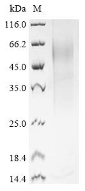 Recombinant Mouse Histidine-rich glycoprotein (Hrg) (CSB-YP010736MO)