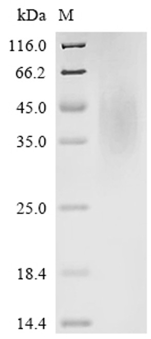 Recombinant Mouse CMRF35-like molecule 6 (Cd300c), partial (CSB-YP004917MO1)