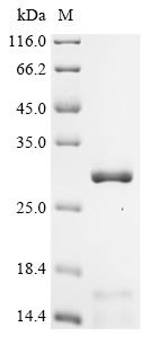 Recombinant Human Metaxin-1 (MTX1), partial (CSB-YP621679HU1)
