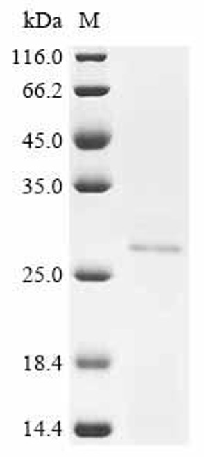 Recombinant Human Adenylate kinase isoenzyme 4, mitochondrial (AK4) (CSB-YP326684HU)