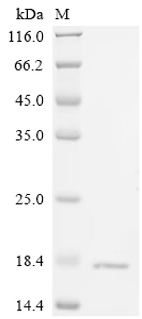 Recombinant Human Fatty acid-binding protein, intestinal (FABP2) (CSB-YP007942HU)