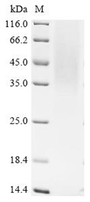 Recombinant Simian retrovirus SRV-1 Envelope glycoprotein (env), partial (CSB-YP356187SHM)