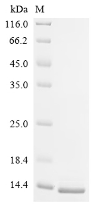 Recombinant Mouse Spectrin beta chain, non-erythrocytic 1 (Sptbn1), partial (CSB-YP733819MO)
