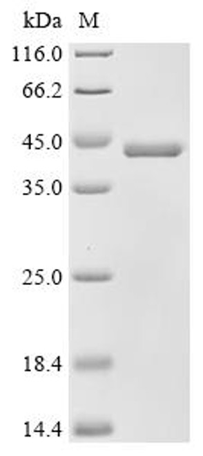 Recombinant Solanum tuberosum Patatin-15 (CSB-YP640821FIG)
