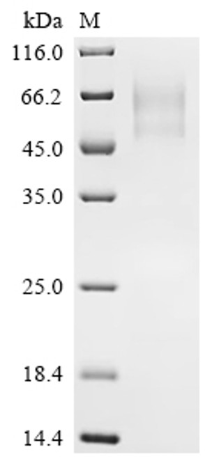 Recombinant Pig Interleukin-6 receptor subunit alpha (IL6R), partial (CSB-YP011665PI1c7)