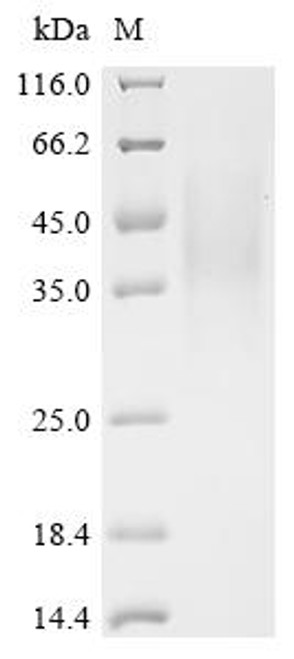 Recombinant Human herpesvirus 6A Immediate-early protein 1 (U90/U89), partial (CSB-YP721301HJZ)