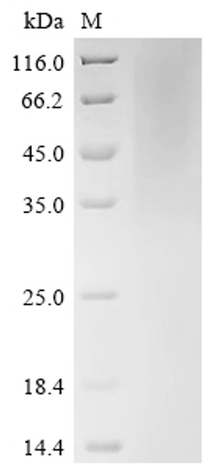 Recombinant Human cytomegalovirus Protein UL16 (UL16), partial (CSB-YP325853HWV)