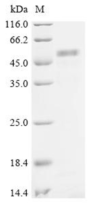 Recombinant Human Na (+)/H (+) exchange regulatory cofactor NHE-RF1 (NHERF1) (CSB-YP021733HU)