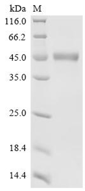 Recombinant Bovine Matrix metalloproteinase-9 (MMP9) (CSB-YP014679BO)
