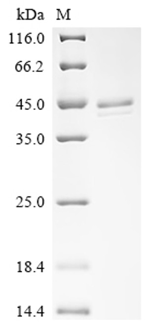 Recombinant Human Lactotransferrin (LTF), partial (CSB-YP013229HU1)