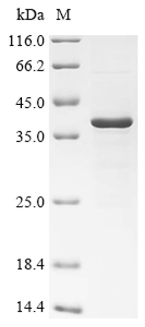 Recombinant Mouse 17-beta-hydroxysteroid dehydrogenase 13 (Hsd17b13) (CSB-EP819744MO)