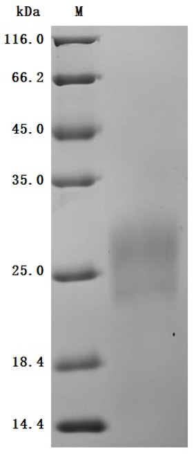 Recombinant Human Gastric inhibitory polypeptide receptor (GIPR), partial (Active) (CSB-MP009438HU1d7)
