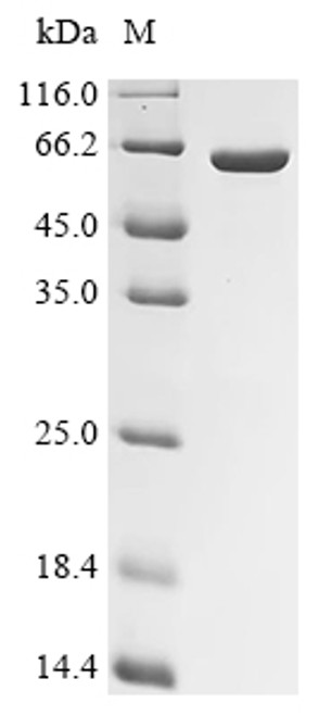 Recombinant Human Mitogen-activated protein kinase 14 (MAPK14) (CSB-EP013453HUe0)