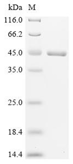 Recombinant Neisseria meningitidis serogroup B Factor H binding protein (fhbP) (CSB-EP5035NGG)