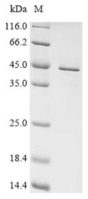 Recombinant Human Small ribosomal subunit protein uS5 (RPS2) (CSB-EP020393HU)