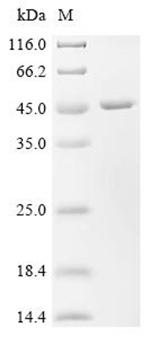Recombinant Human Lactosylceramide alpha-2,3-sialyltransferase (ST3GAL5), partial (CSB-EP890769HU)