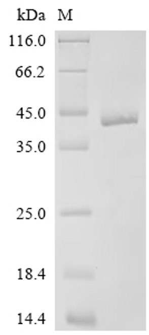 Recombinant Drosophila melanogaster 5-hydroxytryptamine receptor 2B (5-HT1B), partial (CSB-EP010888DLU1)