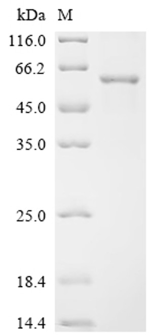 Recombinant Human DNA replication ATP-dependent helicase/nuclease DNA2 (DNA2), partial (CSB-EP006982HU)