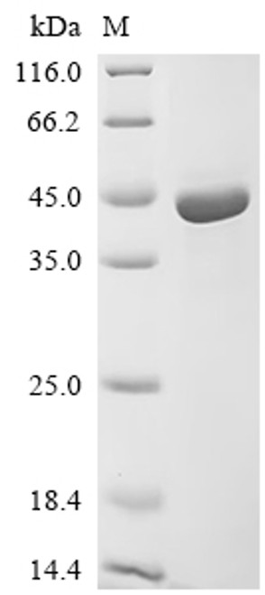 Recombinant Human Adipocyte plasma membrane-associated protein (APMAP), partial (CSB-EP884629HUb1)